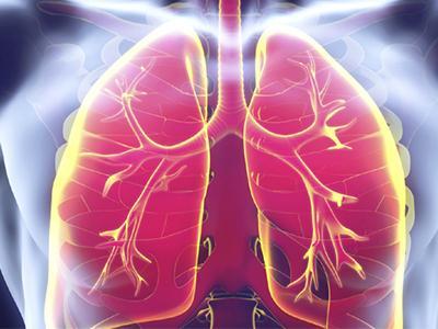 علائم بیماری سل و انواع آن را بشناسید