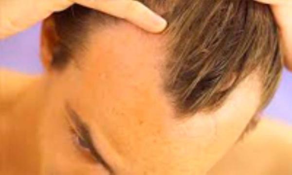 علل شکنندگی موها