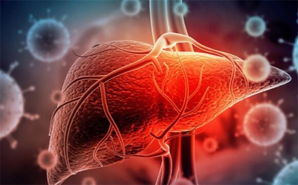 سندرم نفروتیک؛ مشکل جدی برای کلیه ها